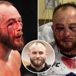 چهره‌ای شکسته و خیره‌کننده: آسیب دیدگی هولناک ماتئوش ربکی، ستاره لهستانی UFC، هواداران را بهت‌زده کرد