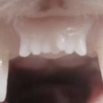 شروع آزمایش انسانی: انقلاب در بازیابی دندان با داروی نوین رشد دوباره!