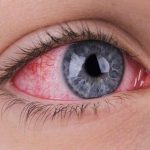 راز پشت پرده سکته چشمی: علل و مکانیزم‌های پنهانی که باید از آن‌ها آگاه باشید