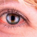 جذابیت و رازآلودی ارگاسم | قرمزی چشم نشانه چیست؟