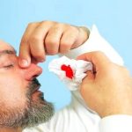 چند توصیه مهم در خصوص خونریزی بینی در گرما