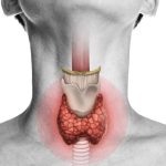 بیماری تیروئید، درمان گیاهی قطعی دارد؟
