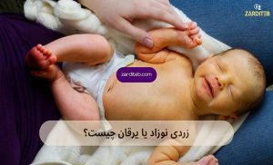 زردی نوزاد چیست؟ | نشانه‌ها، راه‌های درمان، خوراکی‌های مفید و عوارض درمان نشدن