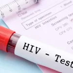 روش جدید پیشگیری از HIV؛ کاهش خطر ابتلا تا ۹۶ درصد