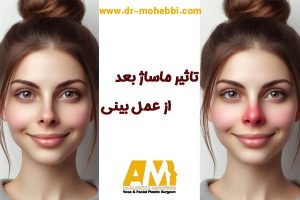 آیا ماساژ بینی بعد از عمل واقعا اثر داره؟